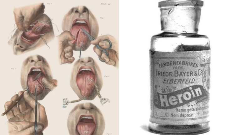 Medicínske domnienky, ktoré nemuseli byť celkom správne.