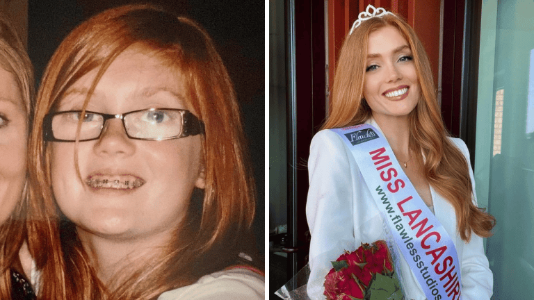 V minulosti ju šikanovali za jej vzhľad, dnes sa stala prvou ryšavou víťazkou v Miss Anglicko