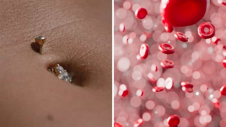 Aj piercing môže mať hrozivé vedľajšie následky. Na čo si treba dávať pozor?