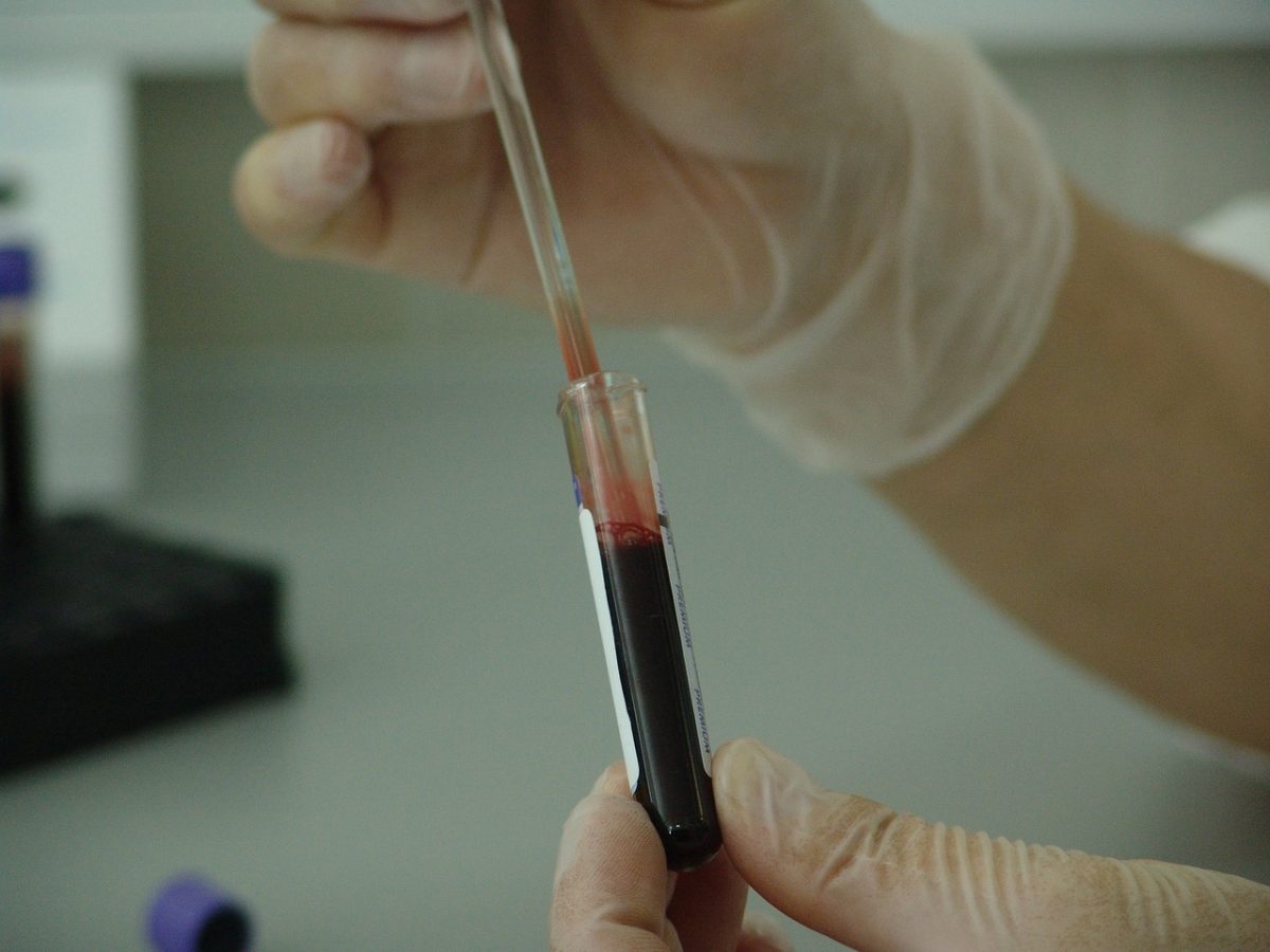 blood, vial, analysis