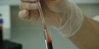 blood, vial, analysis