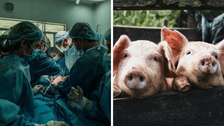 Prvé úspešné transplantovanie prasacej obličky človeku!