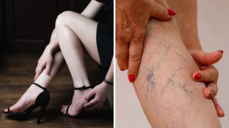 Následky dlhodobého nosenia vysokých topánok – sú vážnejšie ako ste si mysleli!