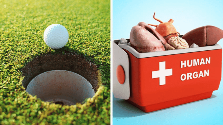 Náhodné zaujímavosti: muž, ktorý používa golfové jamky ako toaletu a akou chorobu trpia koaly