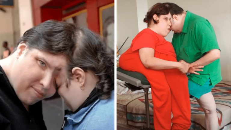 Najstaršie zrastené dvojčatá na svete, George a Lori, zomreli vo veku 62 rokov