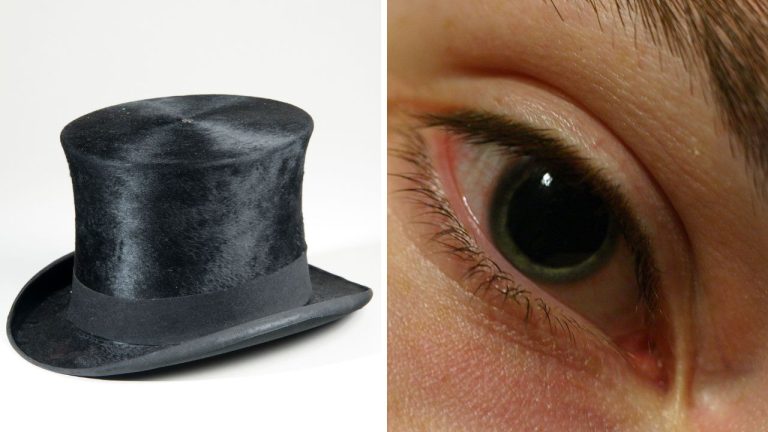 Vzhľad, ktorý zabíjal – módne trendy spojené so smrťou. Pre krásu sa trpí!