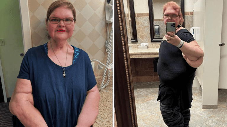 Neuveriteľná premena: Kedysi vážila 325 kilogramov, dnes je to o viac než polovicu menej