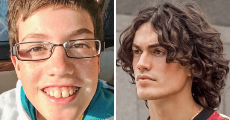 15 fotografií, kedy sa zo škaredého káčatka o niekoľko rokov neskôr stala prekrásna labuť