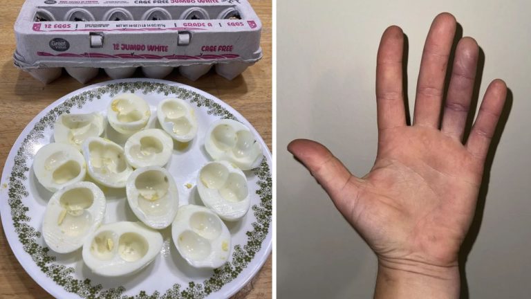 10 náhodných zaujímavých fotografií z internetu #44: Vajcia s dvoma žĺtkami alebo bezdôvodne fialový prst!