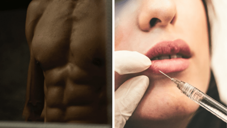 Neuveriteľné možnosti plastickej chirurgie: Ako ďaleko sme sa dostali?