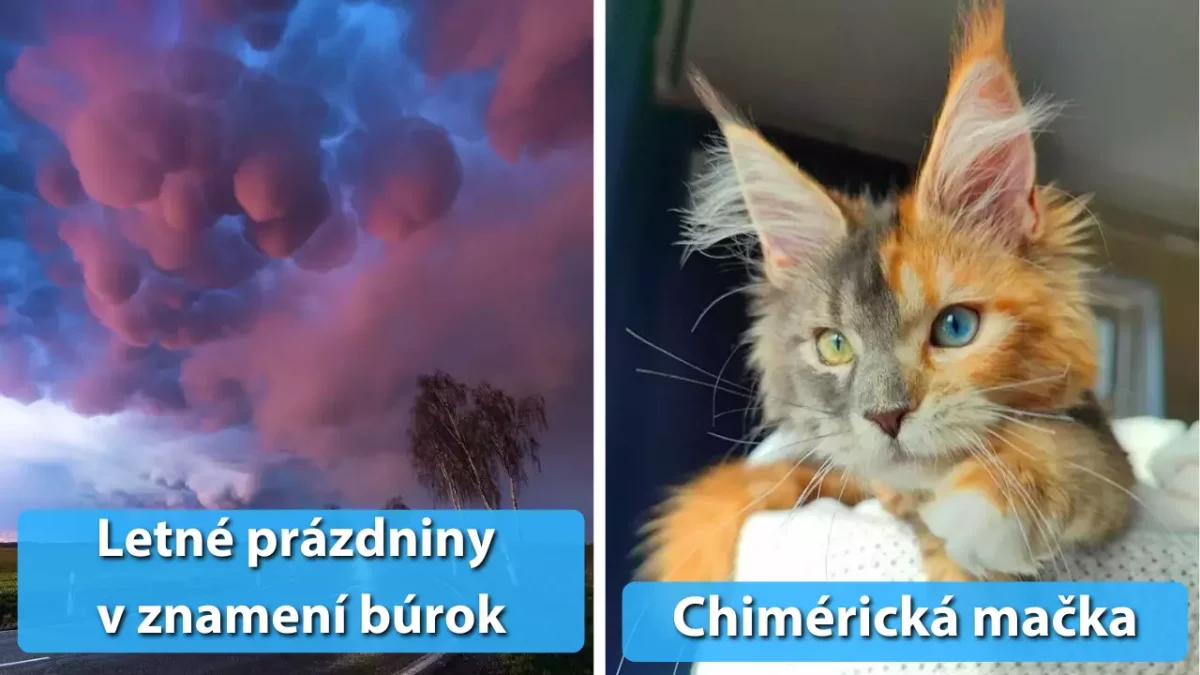 MRI snímky mozgu mladej a staršej osoby vedľa mikroskopického pohľadu na koronavírus.