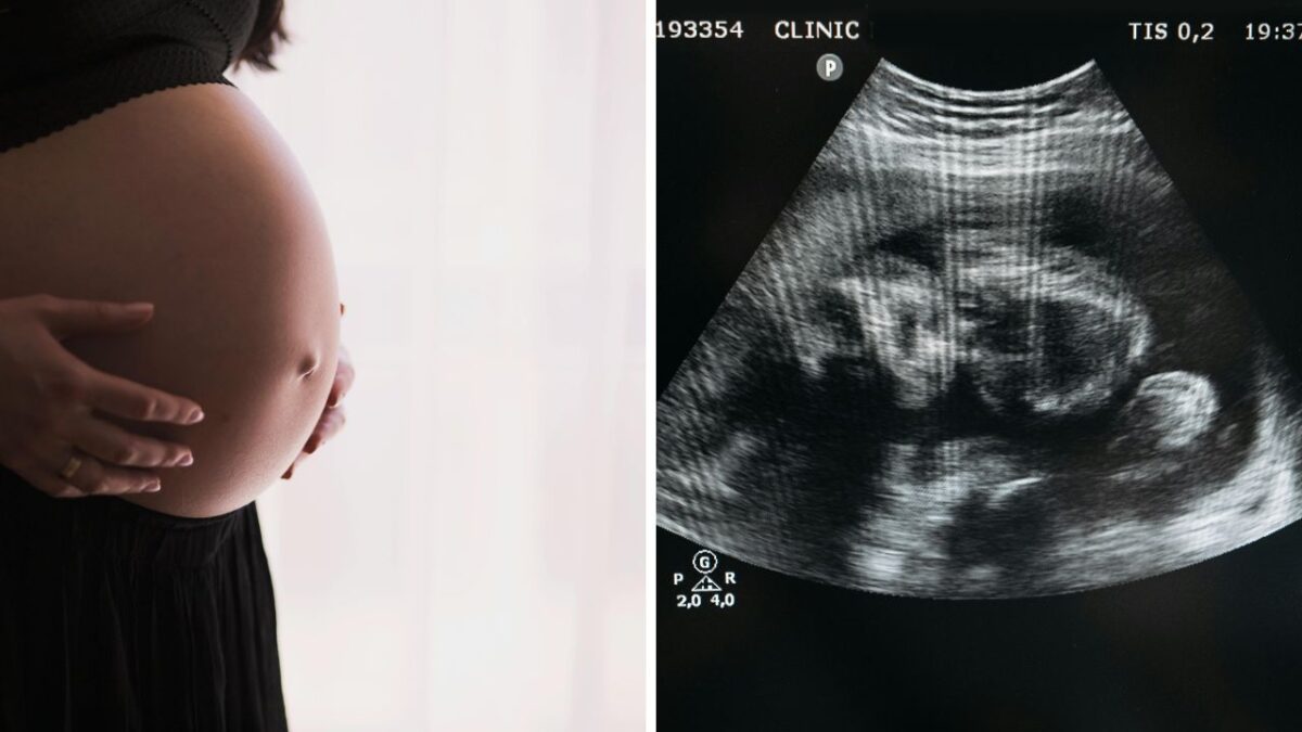 Tehotenské brucho a ultrazvuková snímka plodu zobrazuje rastúce dieťa v maternici.