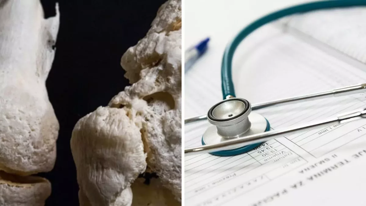 Kostná štruktúra vedľa stetoskopu na zdravotných dokladoch, znázorňuje spojenie medicíny a anatómie.