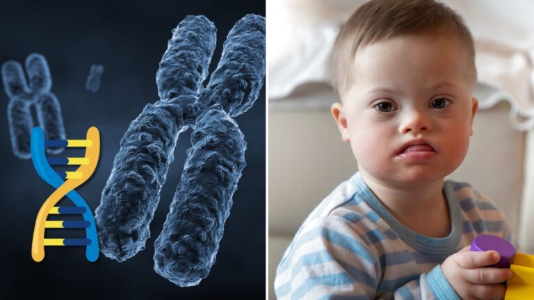 Diagram chromozómov a usmievavý chlapček, tematika genetiky a Downovho syndrómu.