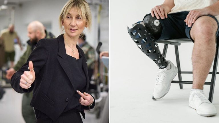 Žena ukazuje gesto, vedľa nej muž s modernou protézou nohy sedí na stoličke v bielej miestnosti.