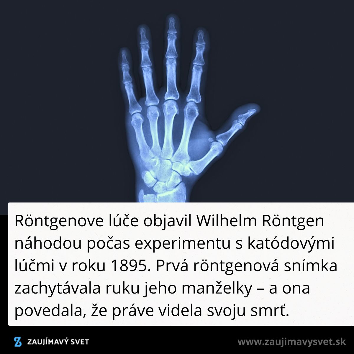 Prvá röntgenová snímka ruky Wilhelma Röntgena z roku 1895, objav röntgenových lúčov.