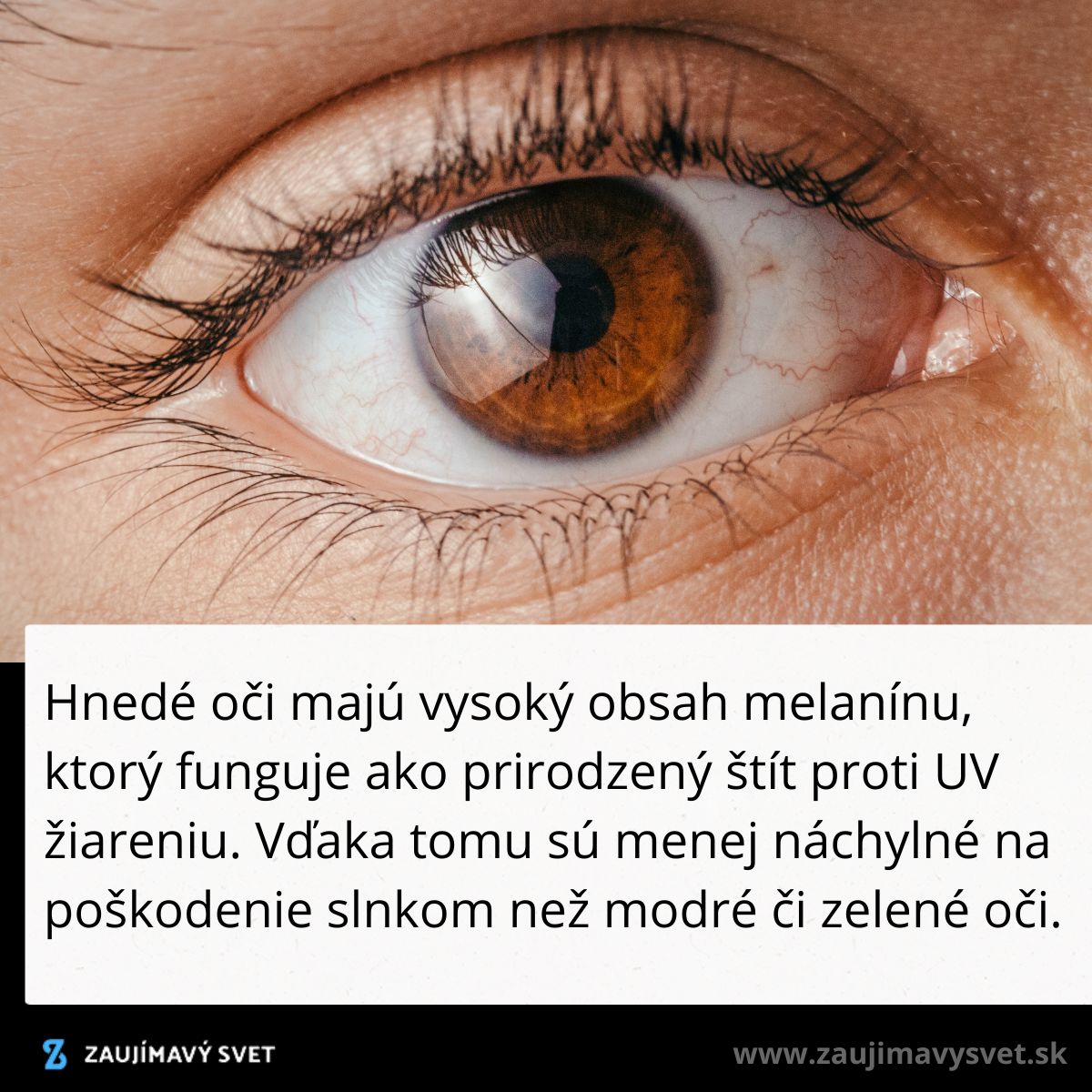 Hnedé oko s vysokým obsahom melanínu, ktorý prirodzene chráni pred UV žiarením a poškodením slnkom.