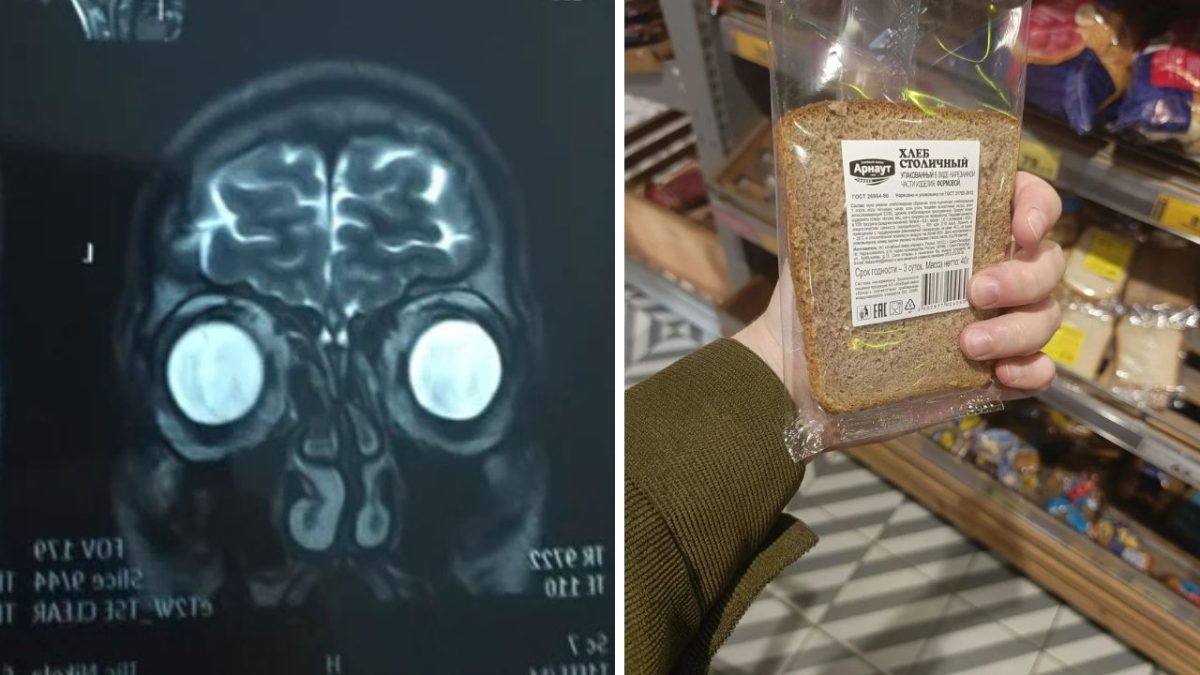 MRI snímka hlavy vedľa baleného chleba v ruke v supermarkete.
