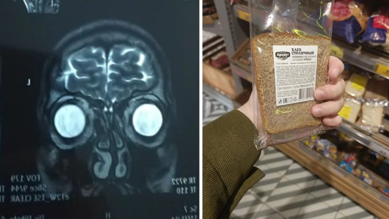 MRI snímka hlavy vedľa baleného chleba v ruke v supermarkete.
