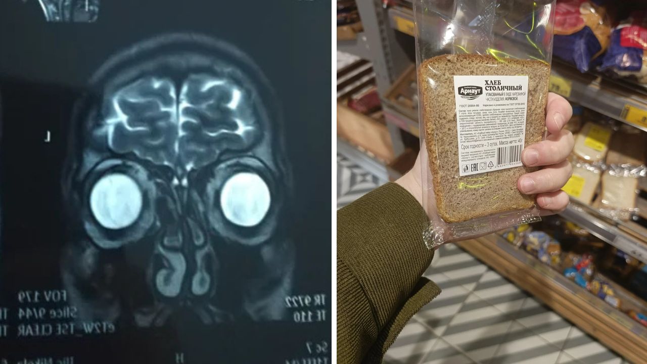 MRI snímka hlavy vedľa baleného chleba v ruke v supermarkete.