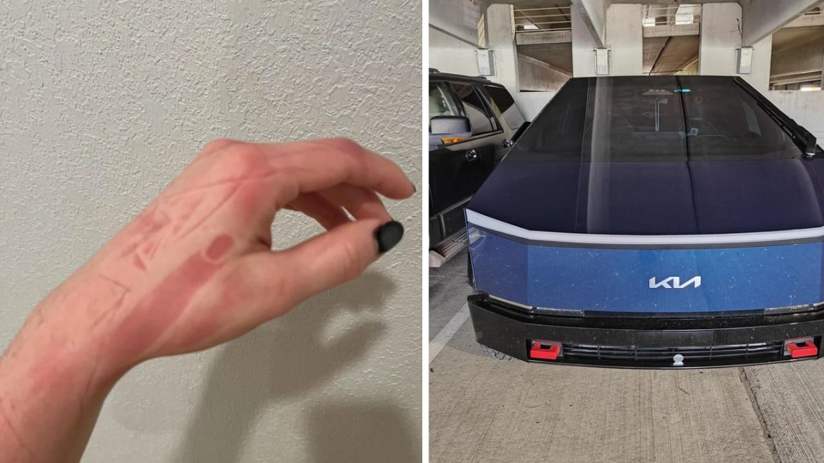 Ľavá ruka s čiernym nechtom na bielej stene a zaparkované moderné auto v garáži.