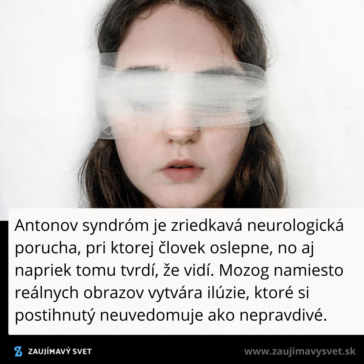 Žena s obviazanými očami reprezentuje Antonov syndróm, kde nevníma slepotu a verí, že vidí.