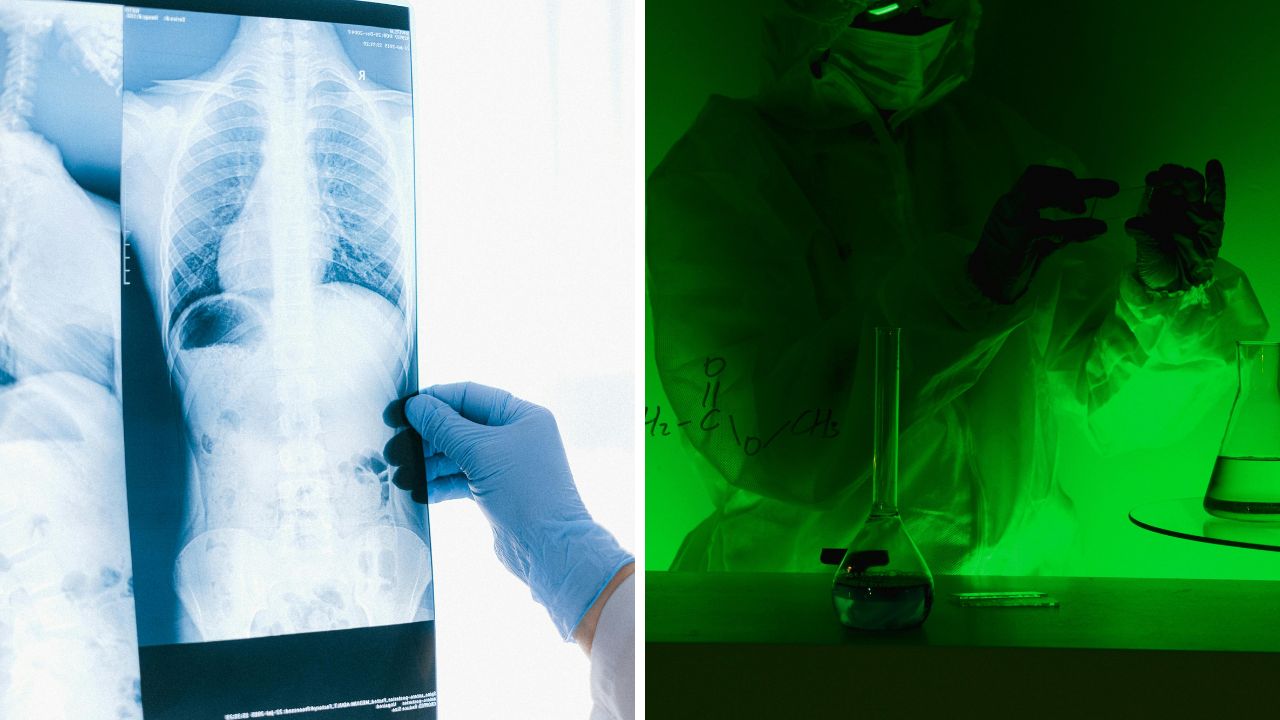 Röntgenový snímok hrudníka vedľa vedca v laboratóriu osvetlenom zeleným svetlom vykonávajúceho experiment.