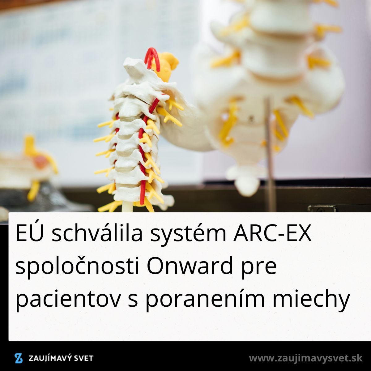 Model ľudskej chrbtice s textom o schválení systému ARC-EX na liečbu poranení miechy v EÚ.