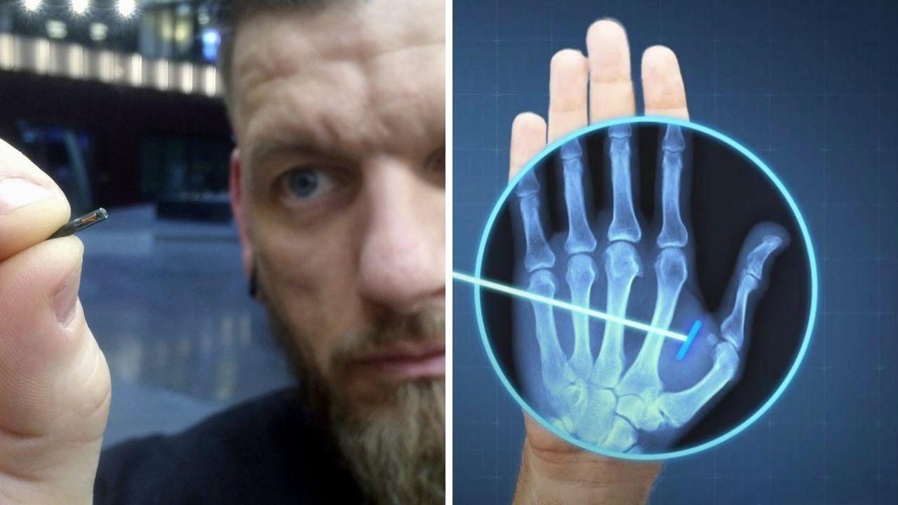 Muž drží malý mikročip; röntgenový obraz ruky s implantovaným čipom pod kožou.