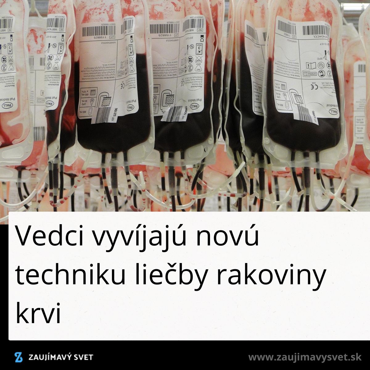 Vak plastových krvných konzerv v rade, symbolizujúcich pokrok v liečbe rakoviny krvi.