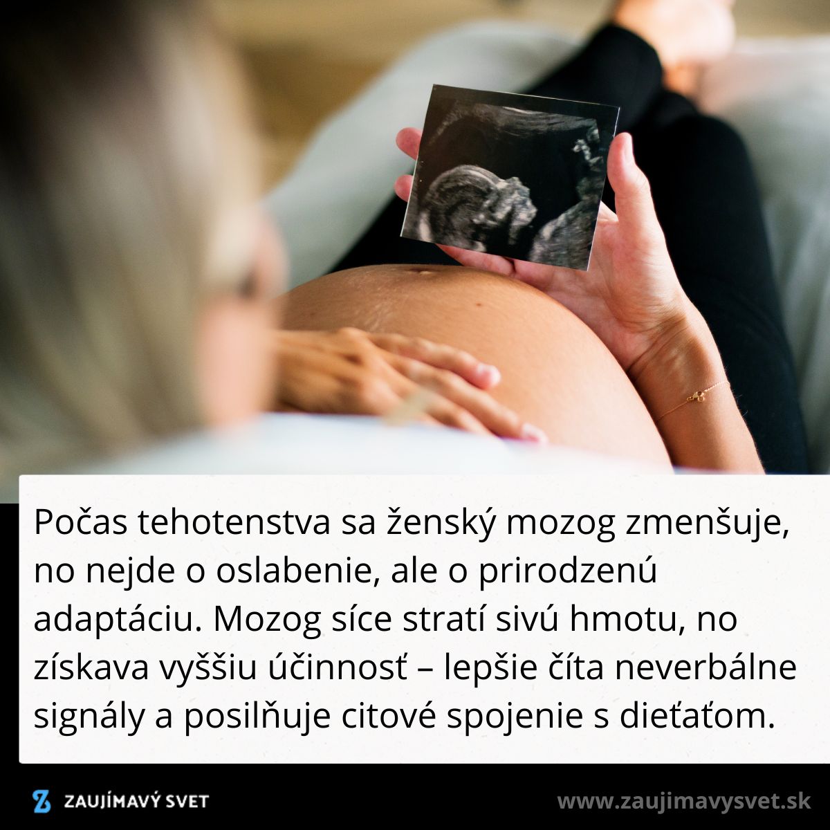 Tehotná žena drží ultrazvukový snímok dieťaťa, text popisuje zmeny mozgu počas tehotenstva.