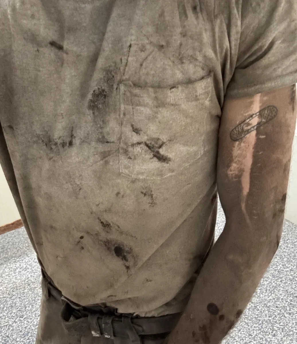 Osoba v zašpinenej košeli so šmuhami a páskou na ruke, symbol pracovnej námahy a zaťaženia.