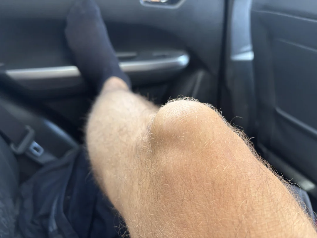 Nohu muža opierajúcu sa o palubnú dosku v aute, v čiernej ponožke na jednej nohe, zobrazenú zblízka vo vnútri auta.