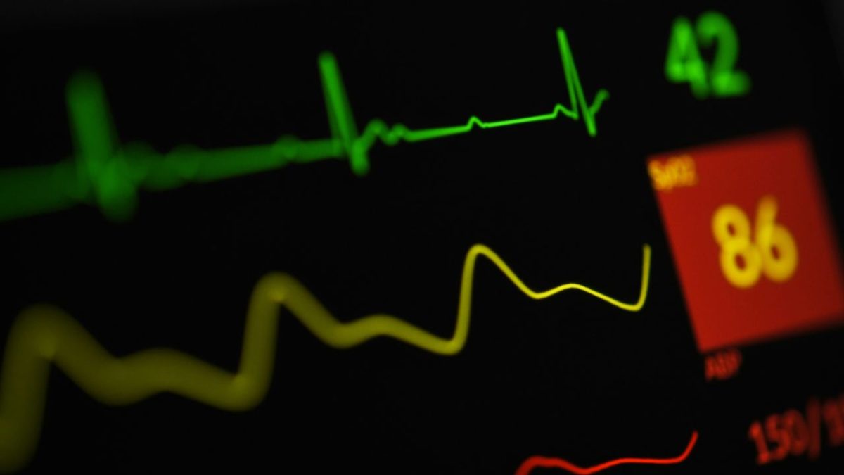 Monitor vitálnych funkcií srdca zobrazuje grafy EKG a hodnoty tepovej frekvencie.