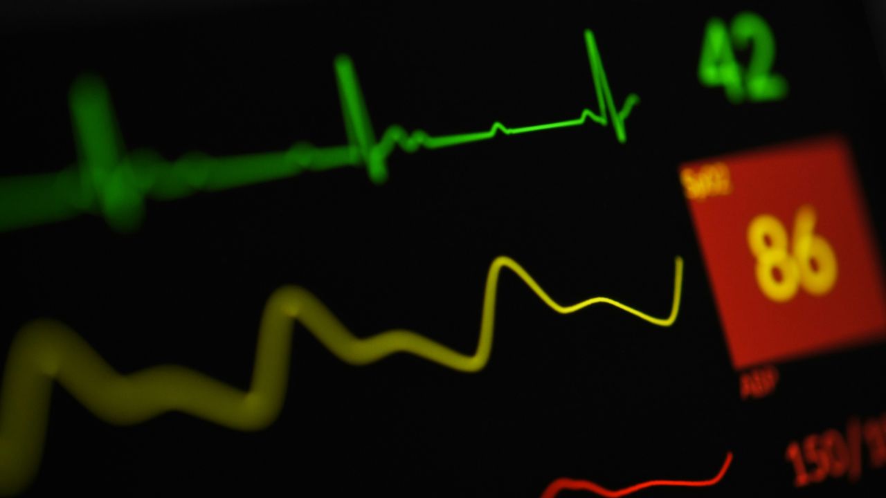 Monitor vitálnych funkcií srdca zobrazuje grafy EKG a hodnoty tepovej frekvencie.