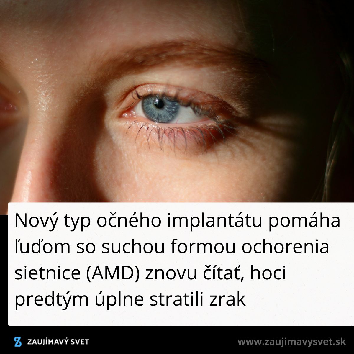 Detailný pohľad na oko, ktoré symbolizuje nádej vďaka novému očnému implantátu pre pacientov so suchou formou AMD.