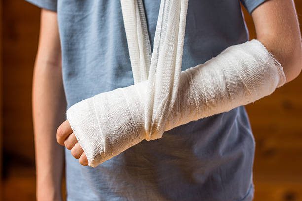 Osoba s modrým tričkom má zlomenú ruku v sadre a podporuje ju pomocou závesu na krku.