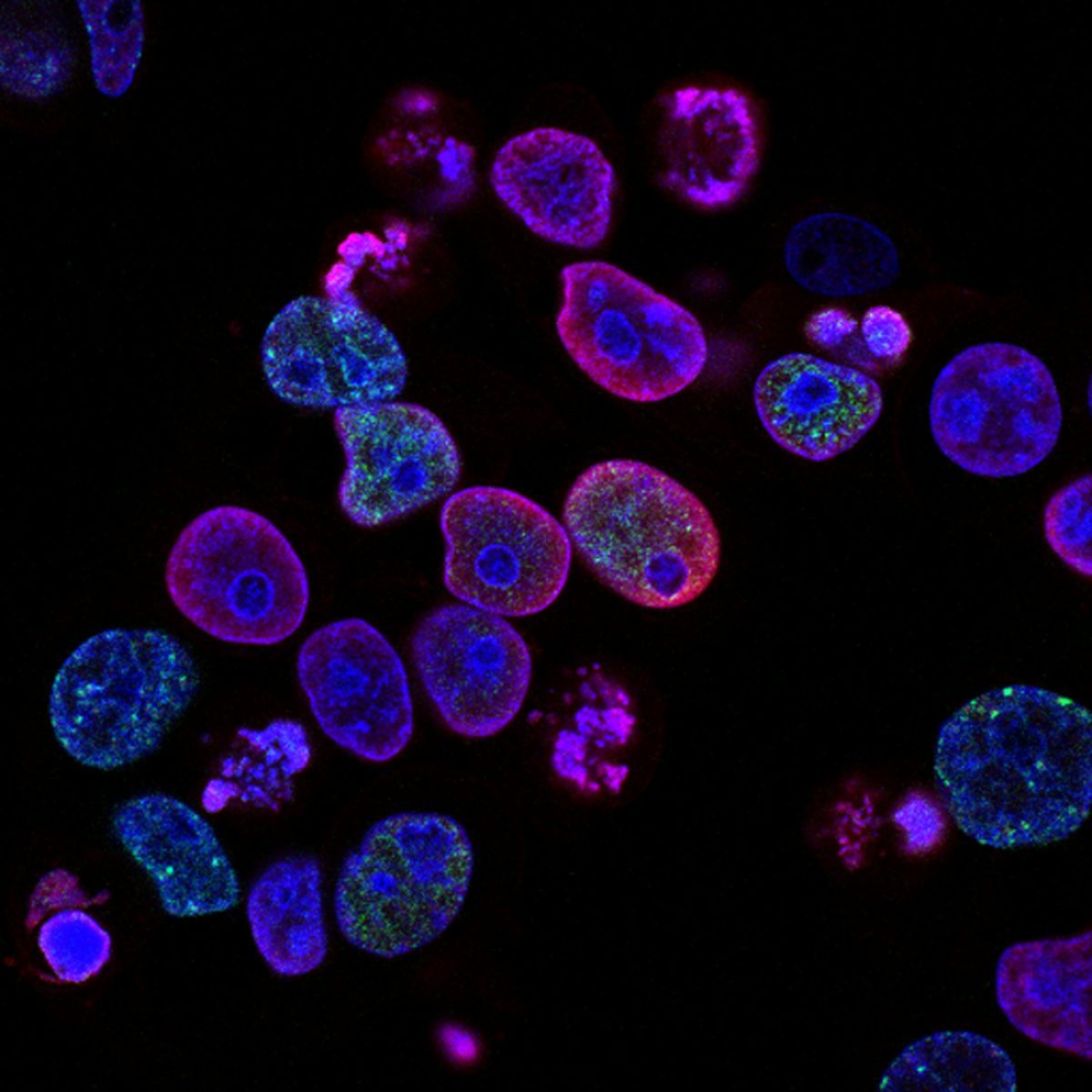 Mikroskopický pohľad na farebné ľudské bunky, zobrazené pomocou fluorescenčnej techniky v laboratóriu.