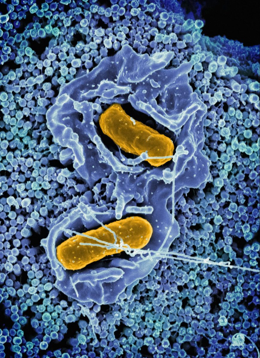 Baktérie Salmonella pod mikroskopom, zvýraznené v žltom, obklopené modrými ľudskými bunkami.