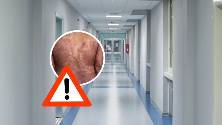 Európou sa šíri nebezpečná „superpleseň“. Lekári varujú, že pred ňou už takmer niet úniku