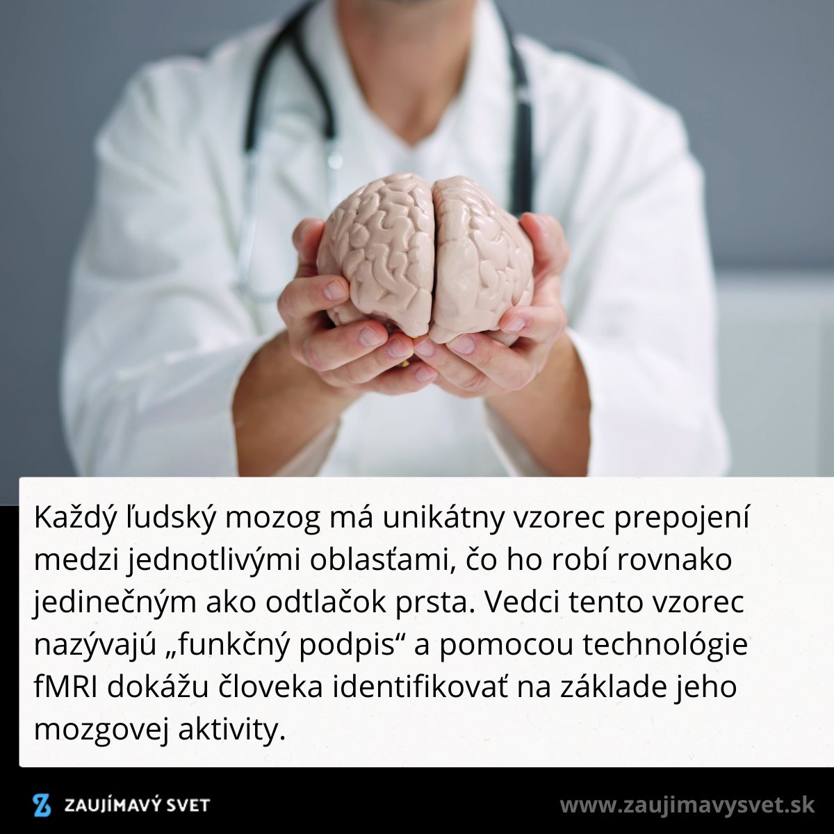 Lekár drží model ľudského mozgu, znázorňujúci unikátny vzorec prepojení medzi rôznymi oblasťami.