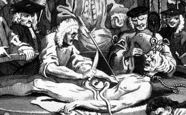 Historická ilustrácia anatomickej pitvy s viacerými pozorovateľmi v tradičných odevoch.