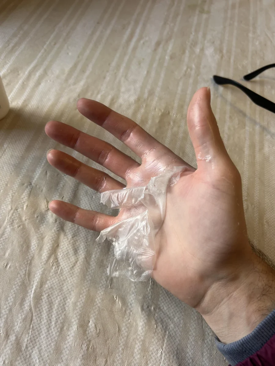 Ruka s odlupujúcou sa vrstvou priehľadného gélu na stole.
