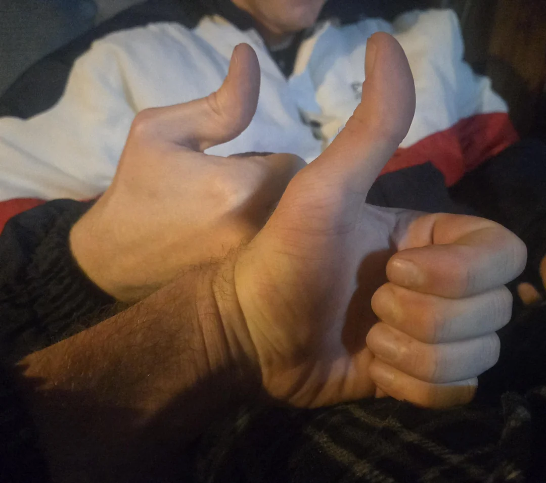 Dve ruky s palcami hore, symbolizujúce súhlas alebo povzbudenie, v neformálnom prostredí.