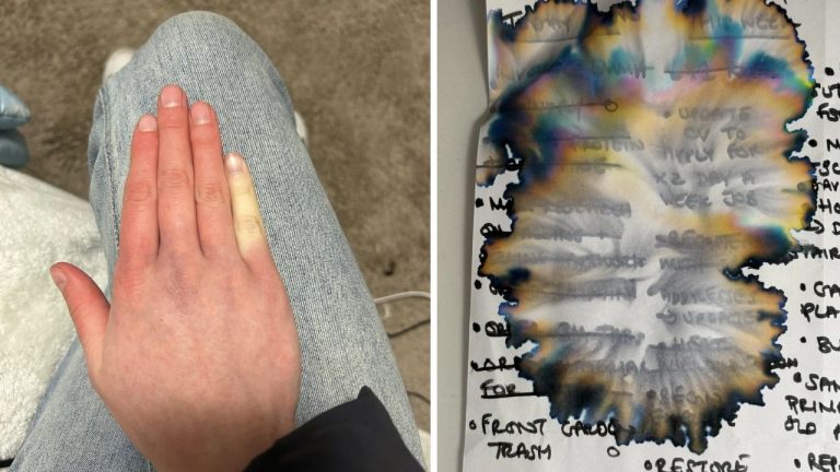 10 náhodných zaujímavých fotografií z internetu #222: Zamaskovaný strom alebo prst inej farby