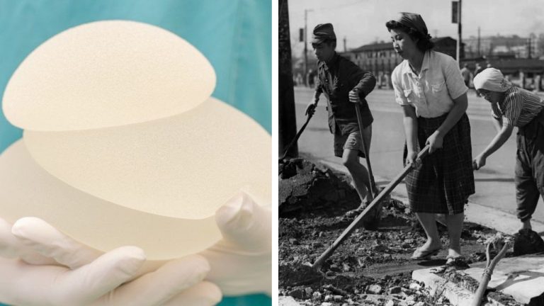 10 zaujímavých faktov o stále obľúbených prsných implantátoch