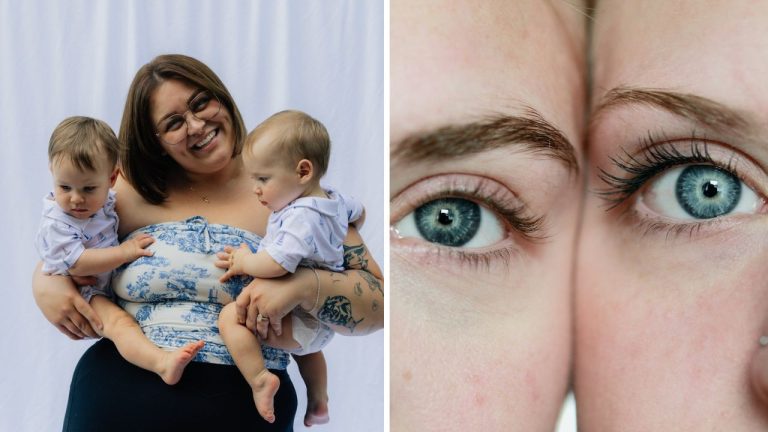 10 prekvapivých faktov o genetickom fenoméne zvanom dvojčatá