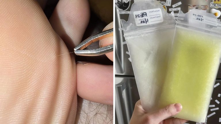 10 náhodných zaujímavých fotografií z internetu #237: Cesnak ako žena alebo tetovanie po schudnutí 38 kg