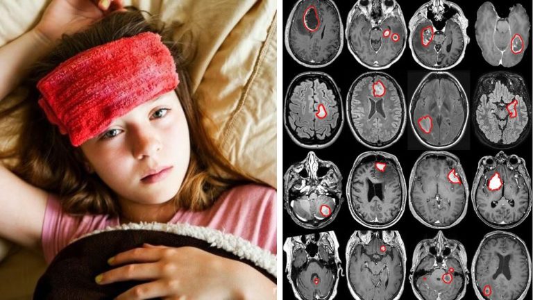 10 vážnych chorôb, ktoré medicína zatiaľ nedokáže úplne vyliečiť