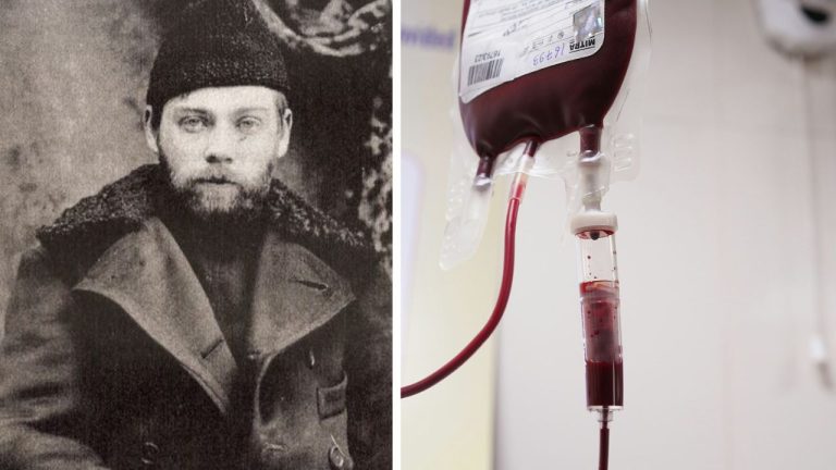Mrazivá história transfúzie krvi: 10 zvláštnych príbehov zo sveta medicíny